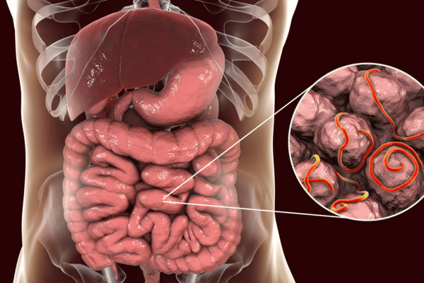 Parasitose Intestinal em Crianças: Entendendo e Protegendo Seu Pequeno